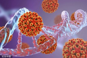 提示肝硬化特别照顾这5种人期望你不在其间 提示肝硬化特别照顾这5种人期望你不在其间