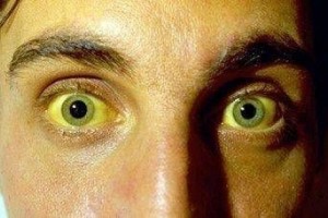 这6种食物堪称是养肝之星每天多吃一点离肝病就远一点 这6种食物堪称是养肝之星每天多吃一点离肝病就远一点