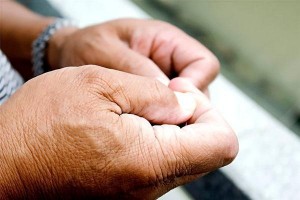 为什么有的人还没到60岁脸上就开端长老年斑了还能去掉吗