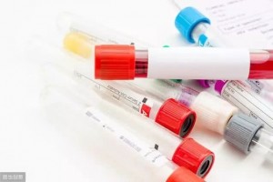 身体有这3症状快去验血脂这是甘油三酯超支了降它得用这3招 身体有这3症状快去验血脂这是甘油三酯超支了降它得用这3招