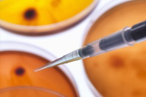每10人中就有一人患有糖尿病干细胞技能能做些什么 每10人中就有一人患有糖尿病干细胞技能能做些什么
