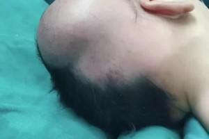 二孩孕妈正漫步宝宝忽然头着地掉出成果触目惊心… 二孩孕妈正漫步宝宝忽然头着地掉出成果触目惊心…