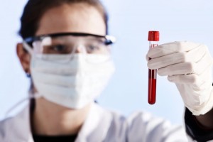 低密度脂蛋白坏在哪里少做这3件事血脂不会飙升 低密度脂蛋白坏在哪里少做这3件事血脂不会飙升