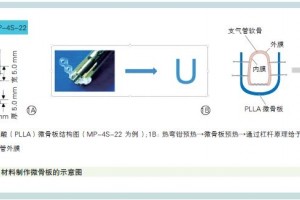 阜外医院立异资料李守军等好方法医治先心病兼并支气管软化