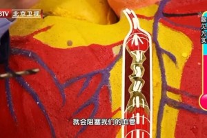 它被称为血管卫兵能壮骨骼护血管日常饮食就能弥补