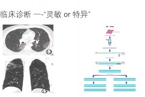新冠肺炎的患者是怎么确诊的重视这2点很重要帮你分辩是否感染新冠病毒 新冠肺炎的患者是怎么确诊的重视这2点很重要帮你分辩是否感染新冠病毒
