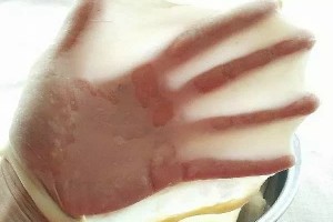 分分钟揉出手套膜的11种方法 分分钟揉出手套膜的11种方法