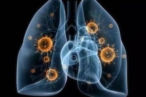 比利时破万全球确诊病例数过万国家达10个 比利时破万全球确诊病例数过万国家达10个
