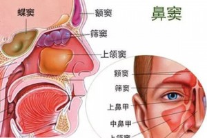 厚朴科普什么是鼻窦癌应该怎样医治