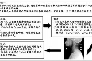 成人无症状前凸型颈椎矢状面平衡印象学参数的相关性特征 成人无症状前凸型颈椎矢状面平衡印象学参数的相关性特征