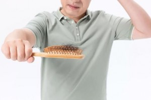 什么是脂溢性脱发患了脂溢性脱发咱们怎么应对看过这篇就知道 什么是脂溢性脱发患了脂溢性脱发咱们怎么应对看过这篇就知道