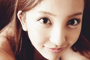 上海丽质美学整形-芭比眼综合真人案例分享 上海丽质美学整形-芭比眼综合真人案例分享